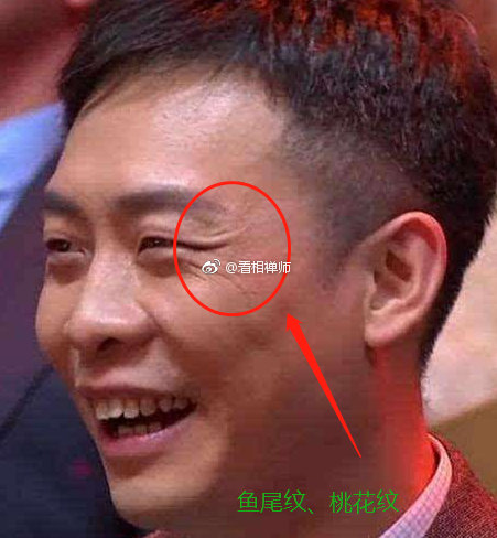 多数是骚气类型2,眼光如水(桃花眼)3,下眼睑漆黑一片4,卧蚕肿胀气色不