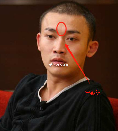 有些粉丝分不清印堂牢狱纹和悬针纹的区别再详细说一说