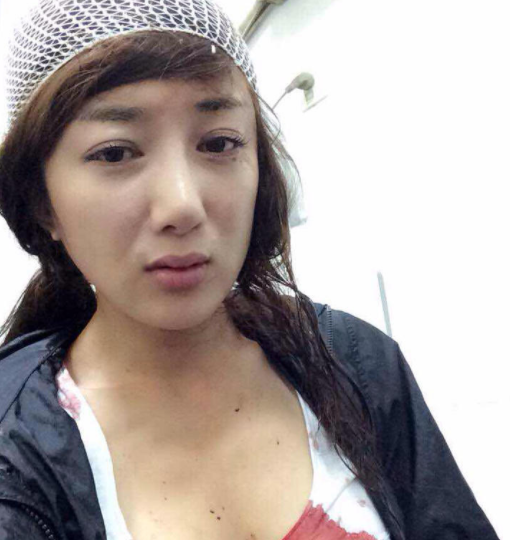 李依晓|毁容|赵丽颖_新浪新闻