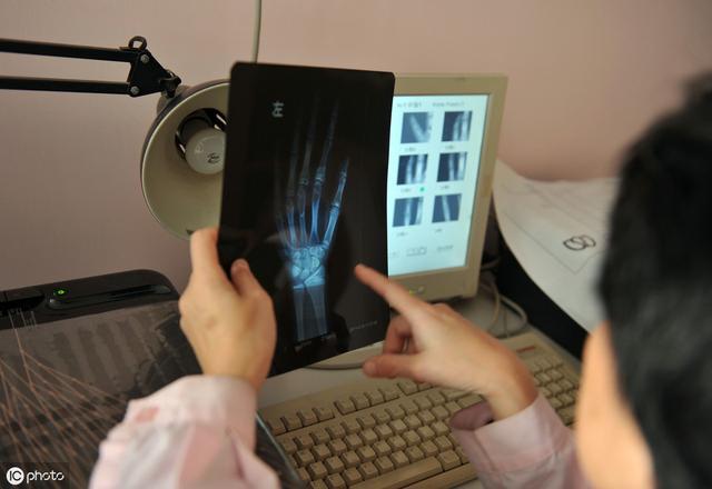 医生为什么要经常测定儿童的骨龄测骨龄主要应用在这几个方面