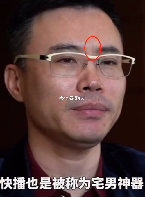 有些粉丝分不清印堂牢狱纹和悬针纹的区别,再详细说一说 - 悬针纹怎么