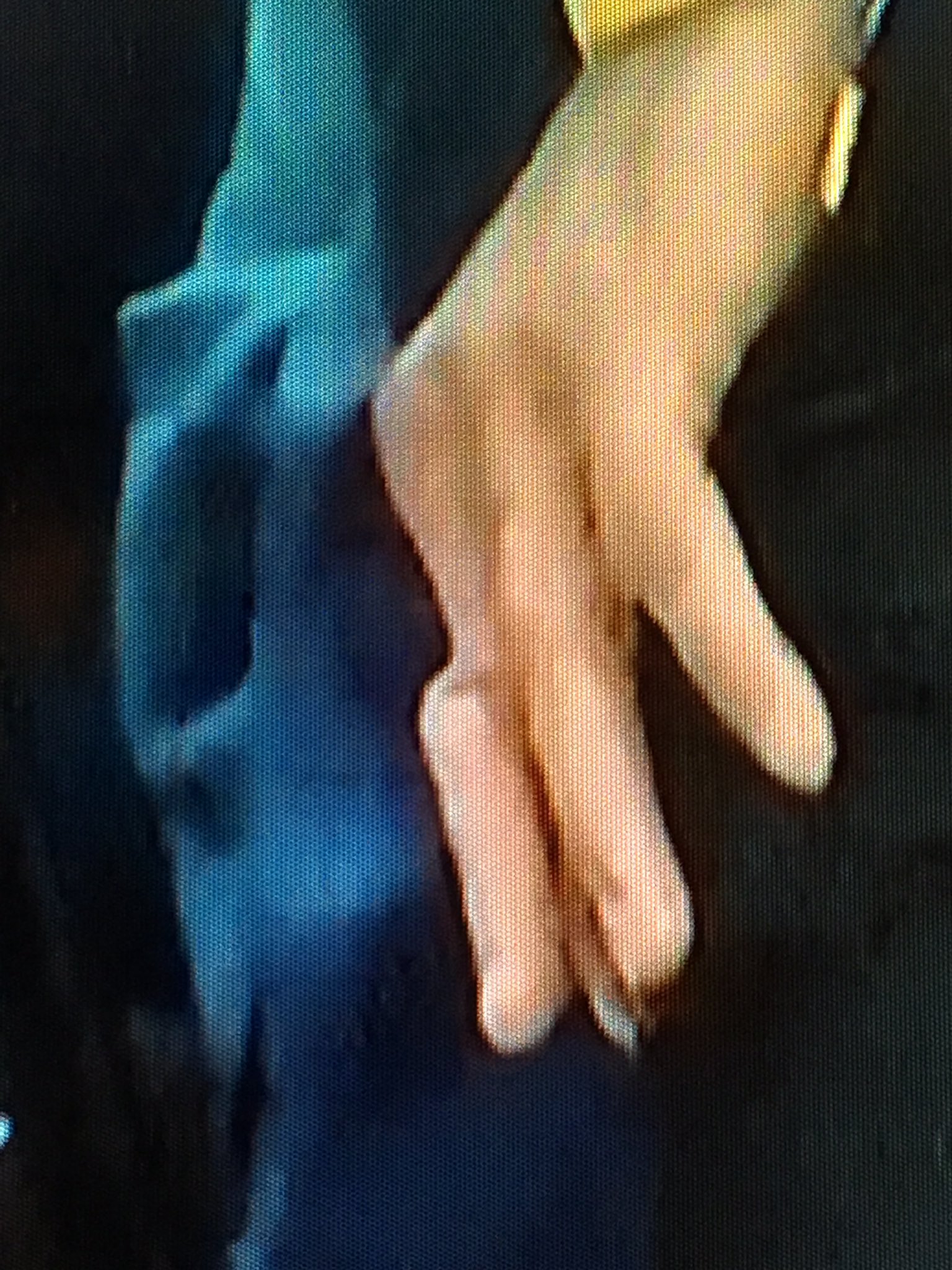 库里手指脱臼,经x光检查结果为阴性后,已经重新回到场上!