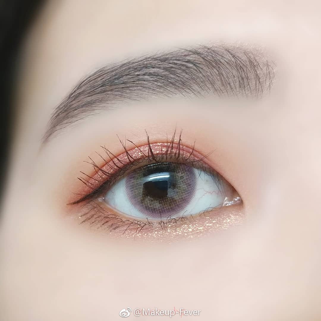 做的双眼皮第三天，有双层，多久能好？