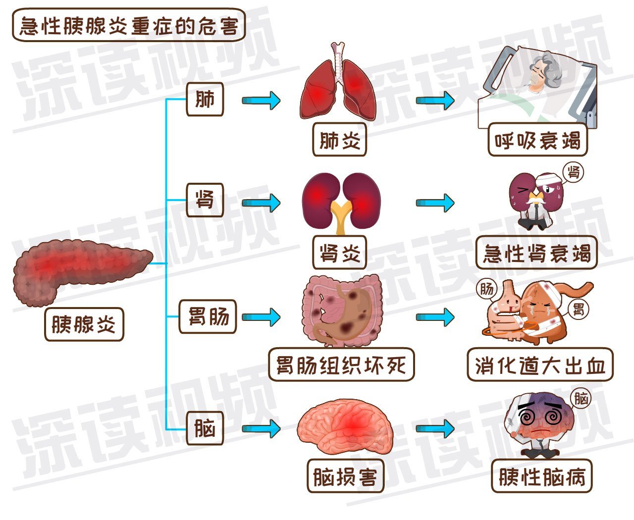 发作起来腹痛似刀绞,致死率高达10%,解密能要命的腹痛之胰腺炎!|解密|急性胰腺炎|胰腺炎_新浪新闻