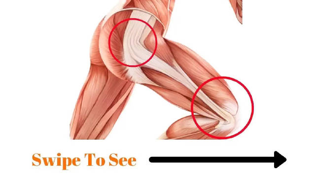 在运动时髂胫束紧张导致的发力过多,会出现髂胫束磨擦综合征