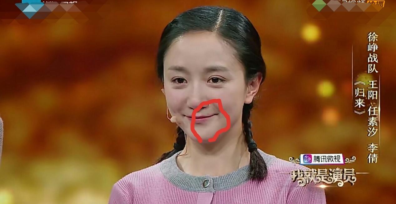 李倩嘴角的痣不见了,这么多年来是被它挡了财路?