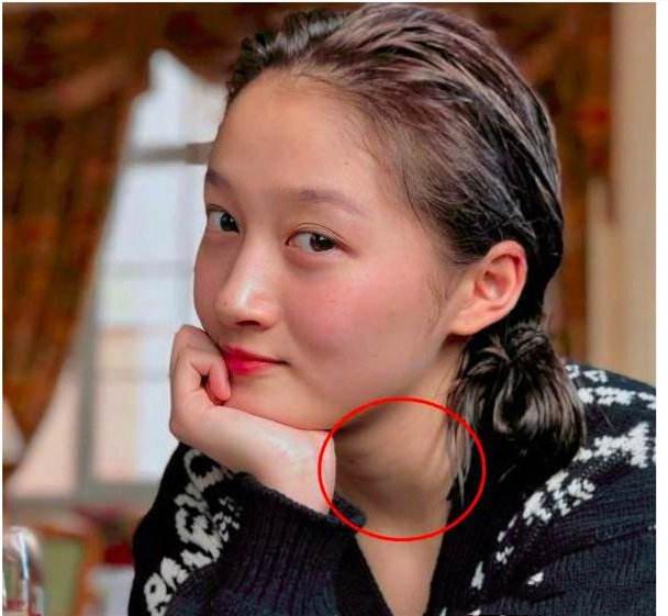 40岁林嘉欣冻龄美貌亮相,却被颈纹出卖?20岁的她也难逃显老魔咒