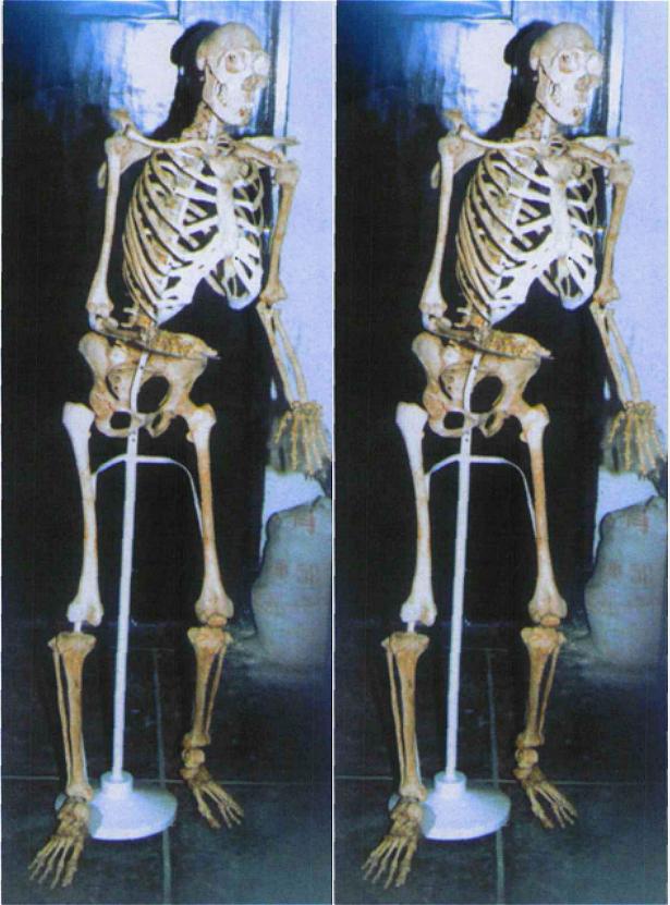 猴娃是人猴杂交的野人?20年前,专家在猴娃遗骨上发现了什么?