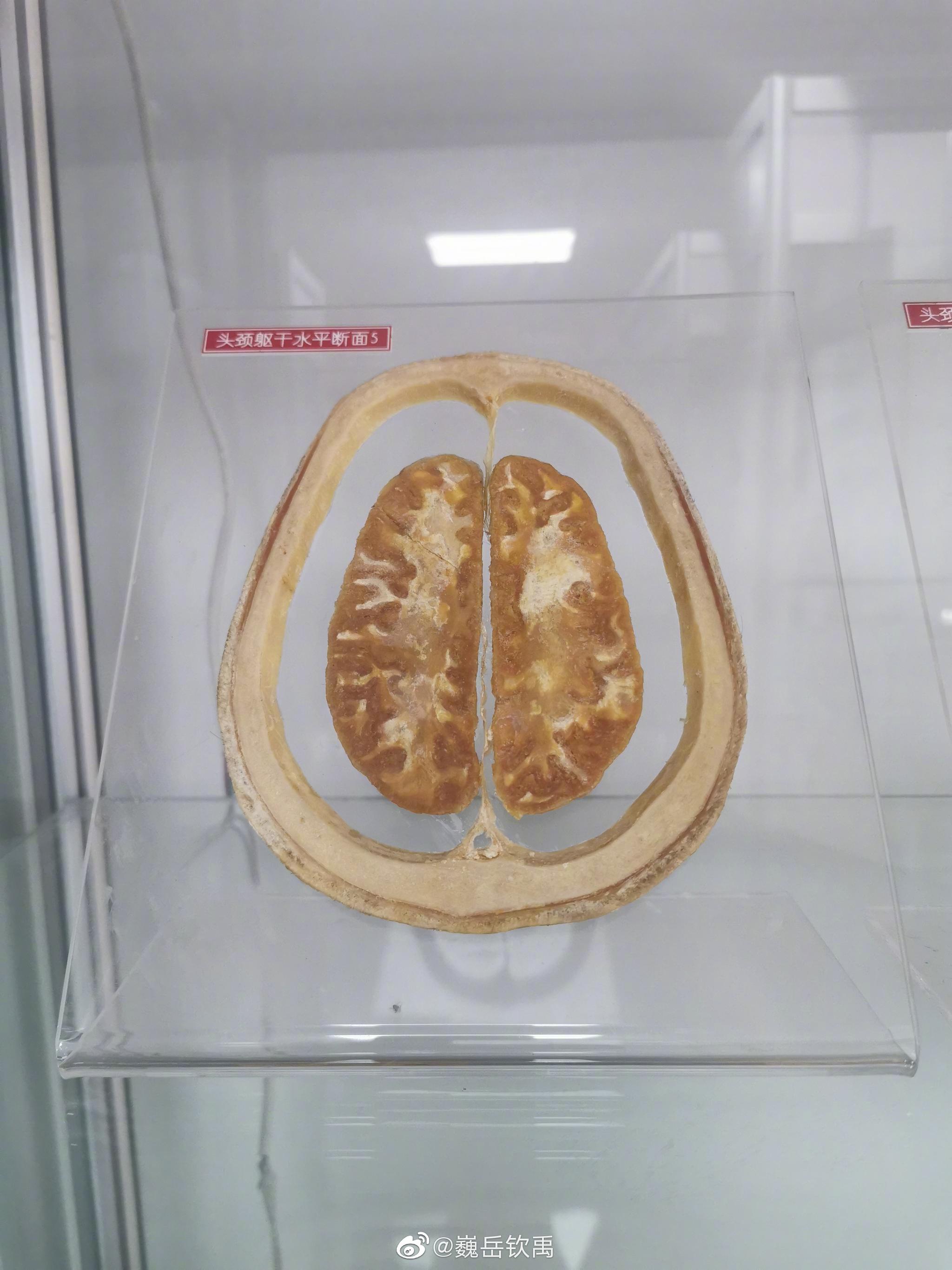 这是一条要用科学眼光看待的微博在医学院里有大量的人体标本