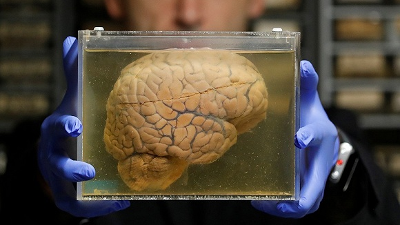 "缸中之脑"能否被解释?人类大脑是颅中之脑,还是缸中之脑?