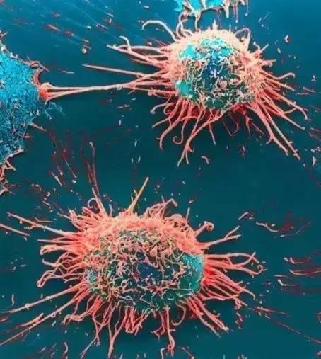 癌细胞正常细胞对比图片