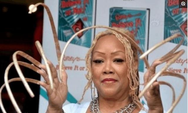 女子12年没剪指甲,生活不能自理犹如废人,吃喝拉撒都要人伺候