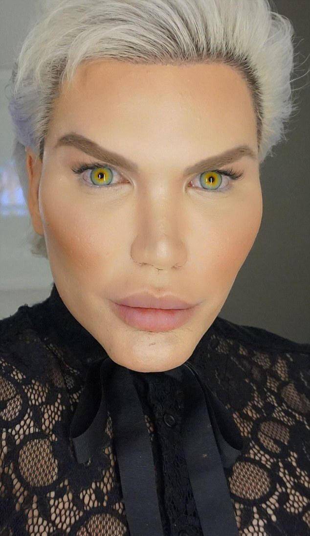 巴西一男子花费530万整容60次,如今脸部僵硬无比!