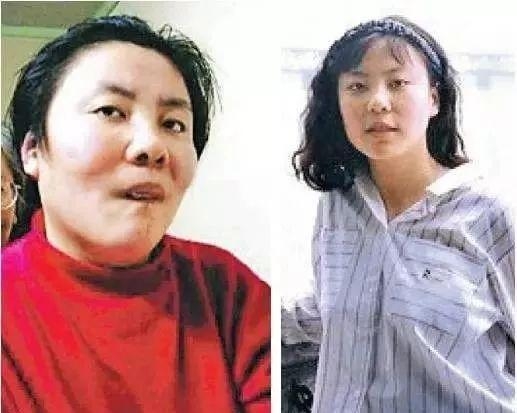 留美中国学生用铊毒杀室友！还记得朱令铊毒案吗？至今成谜|朱令|孙维|铊中毒_新浪新闻