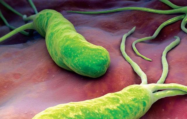 腹泻,便秘,交替进行很多人在被幽门螺杆菌感染之后,都会有排便异常的