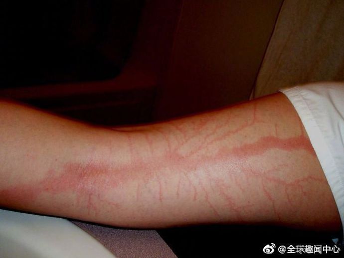 被闪电击中是一件很恐怖的事情,民间说法"遭雷劈"