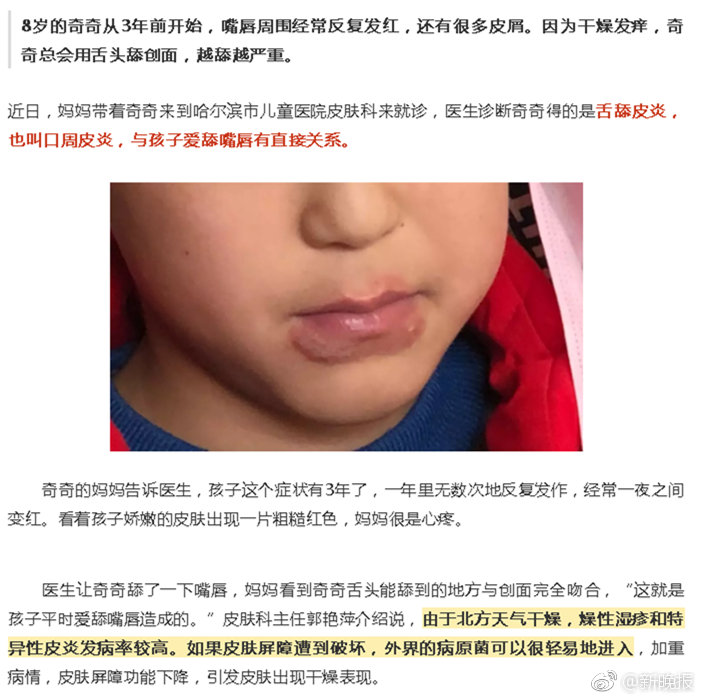 舔嘴唇舔出皮肤病 孩子最爱得|奇奇|口周皮炎|皮屑_新浪新闻