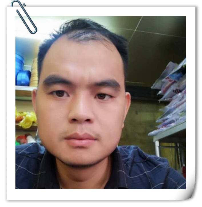 面相生有罗汉眉,主婚晚子迟,眉毛浓,眉毛有些卷曲,眉尾下垂压奸门为