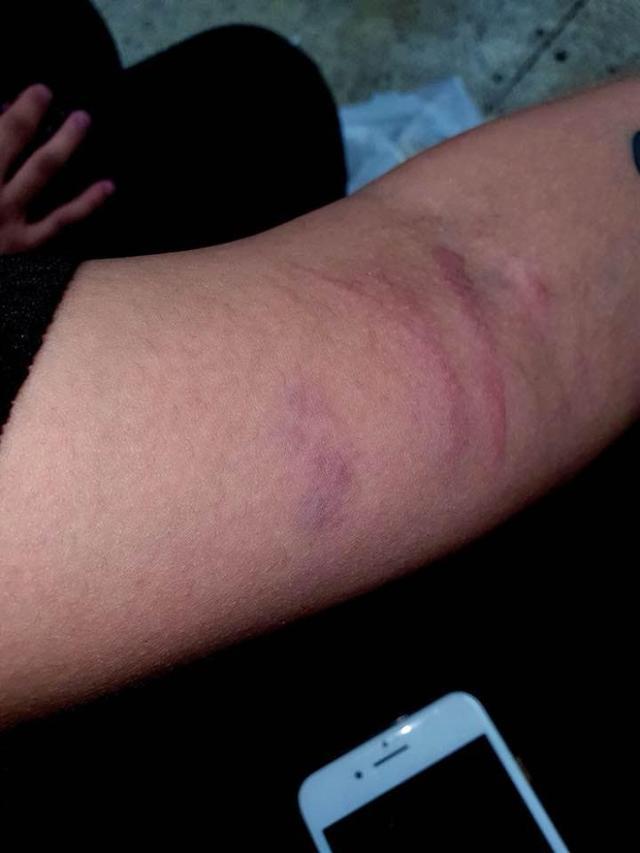 瑞典女子在韩国问女孩借厕纸,惨遭暴打多处淤青被骂"滚出韩国"