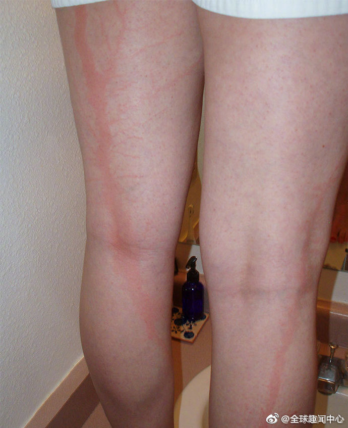 被闪电击中是一件很恐怖的事情民间说法遭雷劈