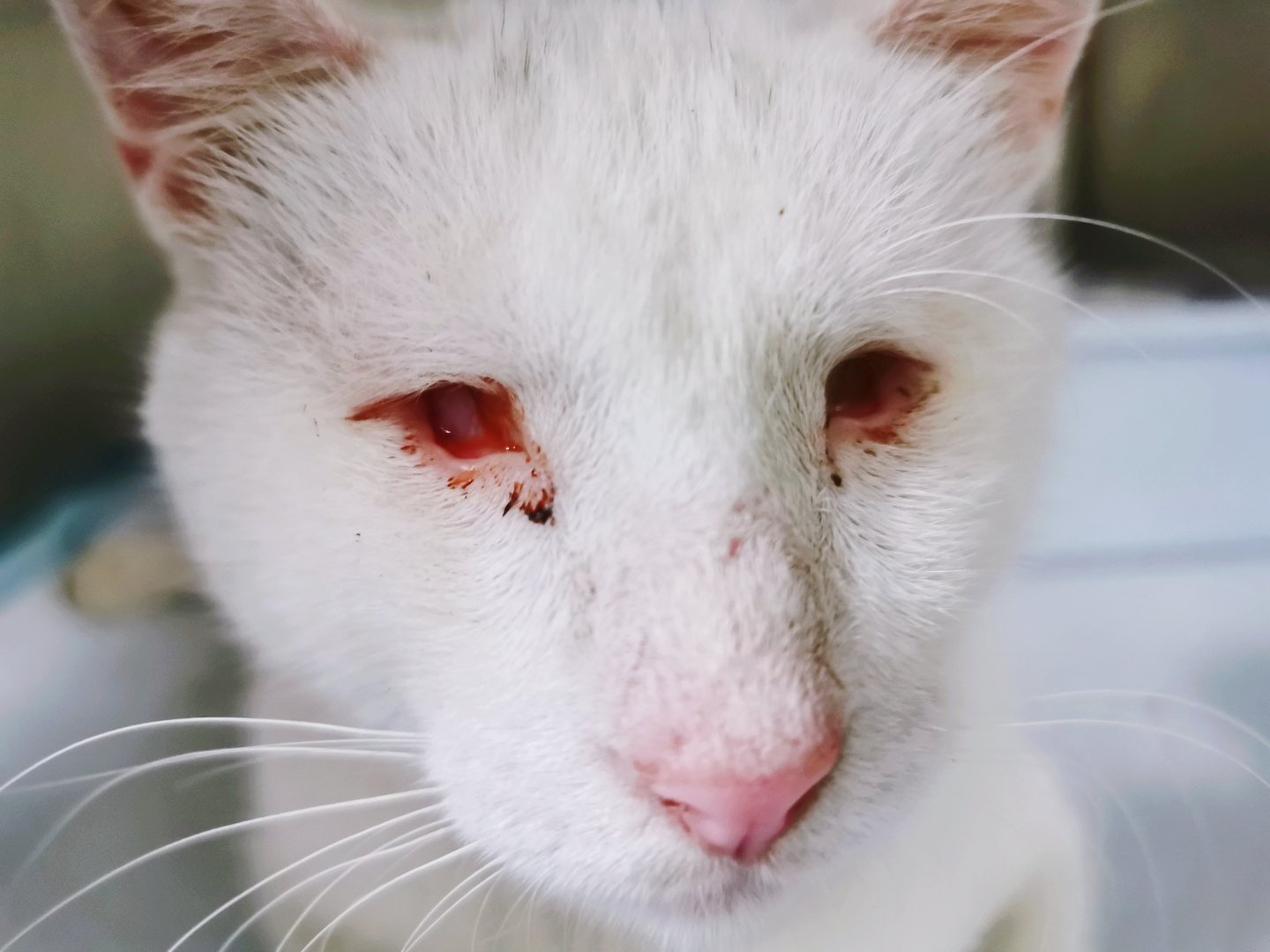 瞎子眼睛到底怎么会成这样的天生后天人为