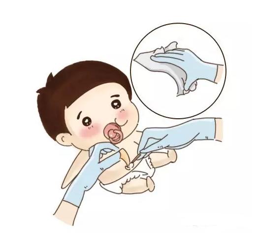 如何清理宝宝肚脐才不会引起感染发炎