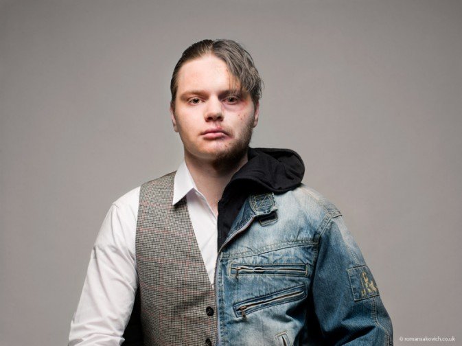 今天是国际禁毒日,为大家介绍一组禁毒主题的摄影作品《半个人》