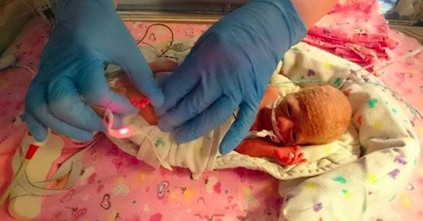 28周出生的早产儿仅0.99斤,因"袋鼠疗法"最终凭借毅力活了下来