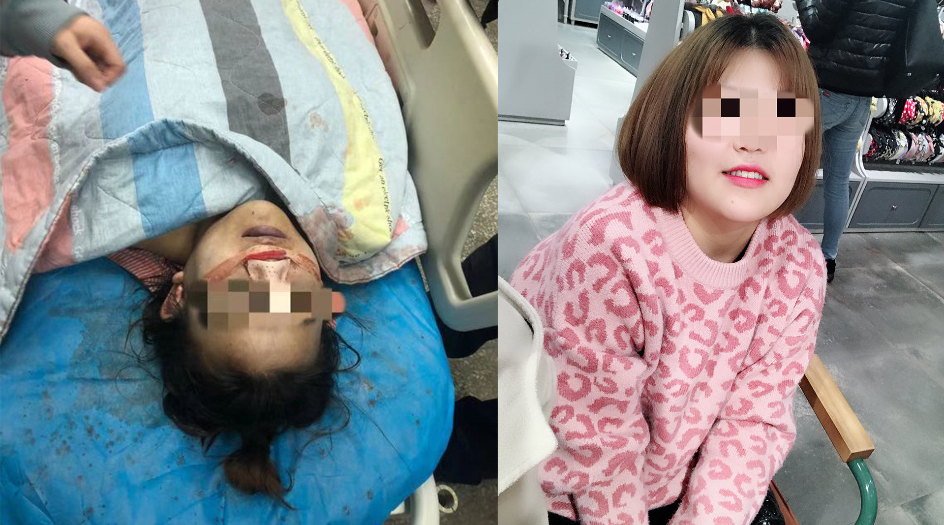 女生隆鼻时身亡 整容医院背后还有多少违规操作?