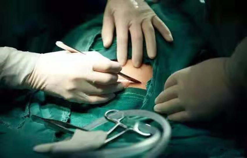 剖宫产手术划伤娃医生没太大问题六年后妈妈不是没事儿吗