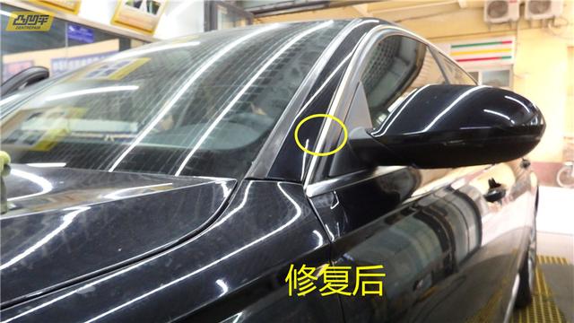 拓范凹陷修复：让肌肤焕发新生的秘密武器