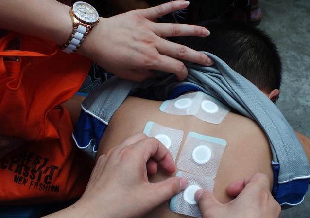 若给不适宜人群贴敷三伏贴,不仅对贴敷者无益,贴敷者可能反受其害.