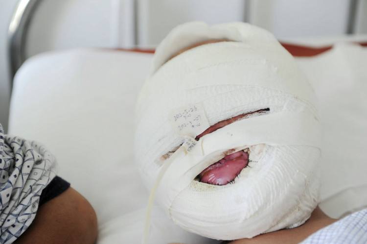 4岁孩子血管破裂,竟是父母如此给孩子吃东西,家长长点心吧!