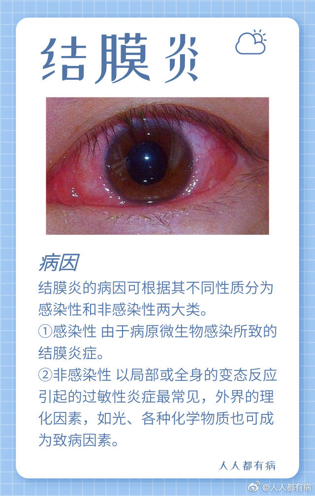 结膜炎