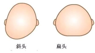 脑勺高聪明包宝宝头型与智商挂钩家长们别再被误导了