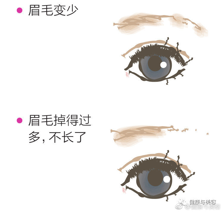 眉毛的生长循环周期长 大约是90 1天 但是随着年龄增加 眉毛的生长循环周期长 大约是90 1天 但是随着年龄增加