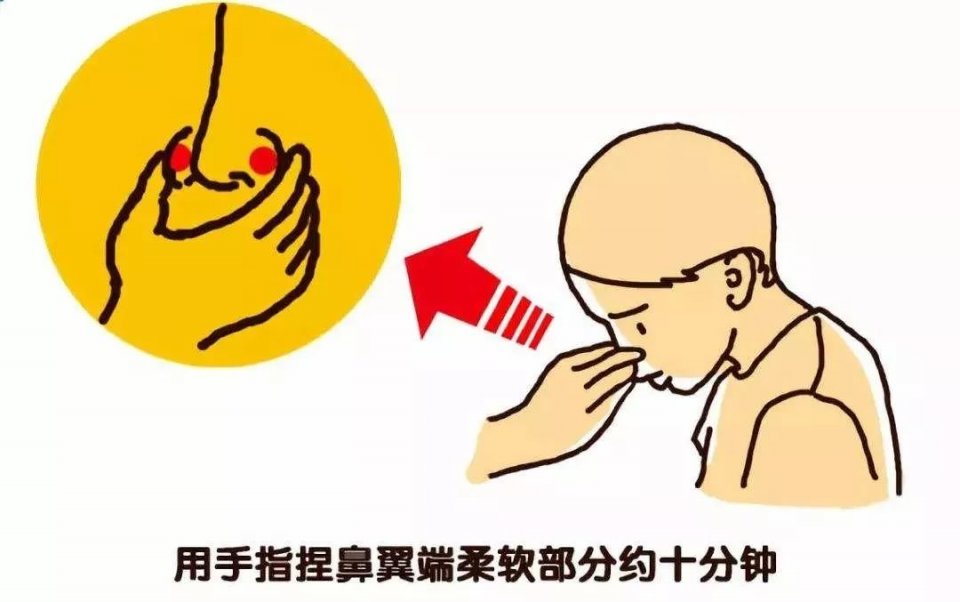 宝宝流鼻血就赶紧塞纸团?小心有窒息危险