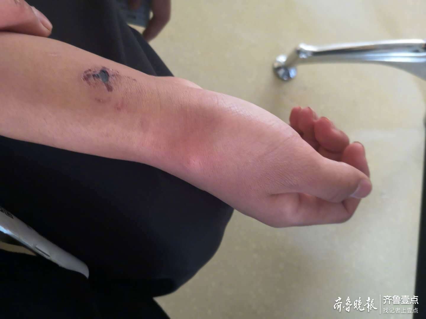 济南16岁学生遭3室友殴打,门牙都断了 校方回应:正协调赔偿