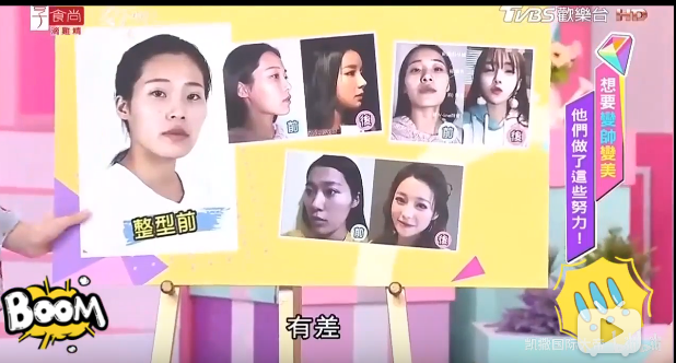 花20万8小时换脸,术后3天带止痛药去逛街?模特业竞争太激烈了
