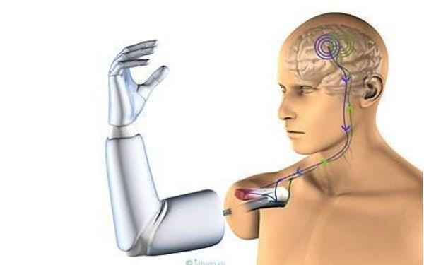 随着5g来临,假如人类身体植入芯片,会让人体智能化吗?