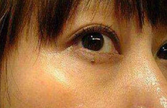 怎样洗夏天白色网状型鞋不发黄？