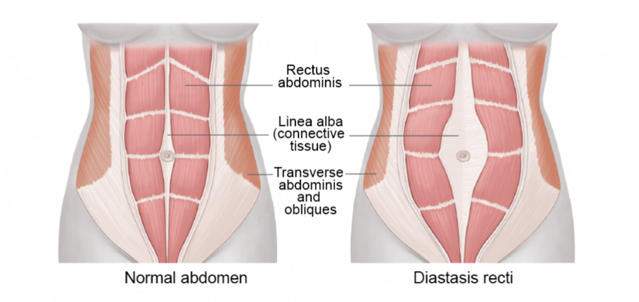 腹直肌|茉莉|腹部_新浪新闻