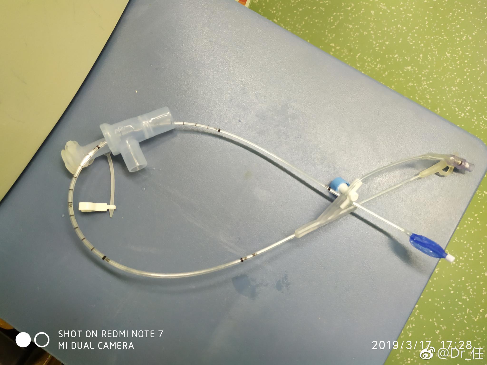 行肺叶切除,婴幼儿无法使用双腔管时需要单肺通气可选择支气管封堵器