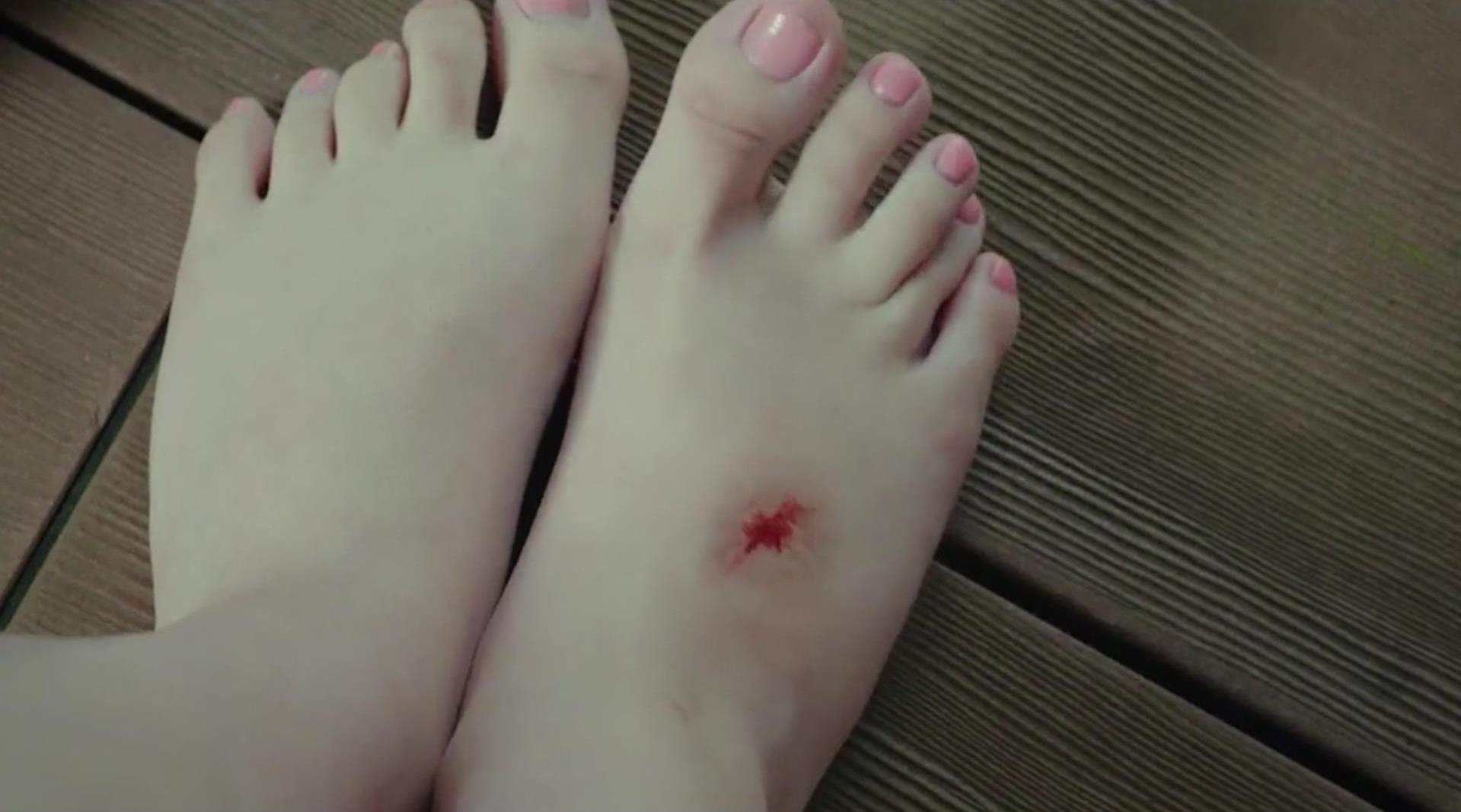 女孩的脚划破一个口子,皮肤竟瞬间老化