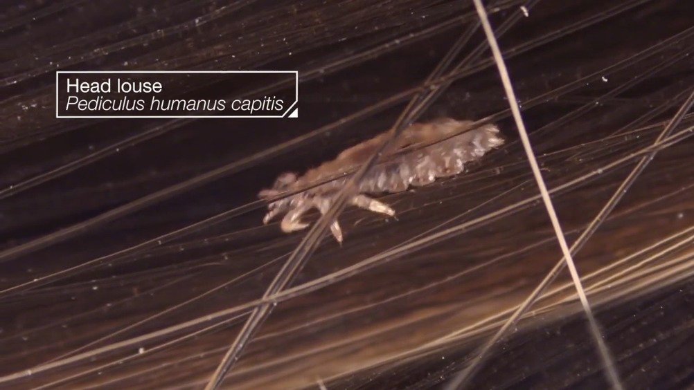 显微镜下的高清虱子虱子挺钟情的,他只能活在一个物种的身上