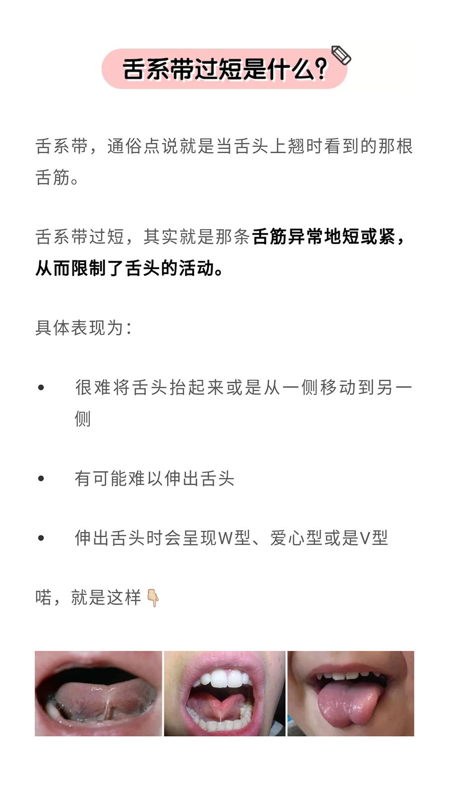 最近编辑部的vivi特别愁,自家娃都2岁半了,讲话却依旧含含糊糊的|舌系带|编辑部|讲话_新浪新闻