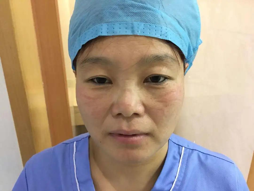 包含开封市第一人民医院黄牛跑腿号贩子挂号的词条