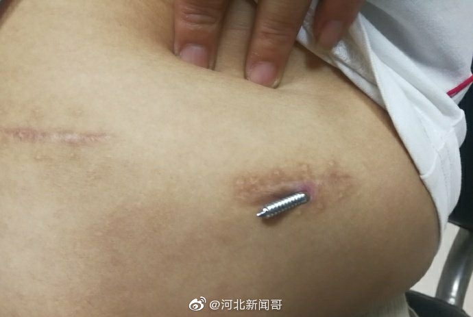 石家庄一年轻吸毒男子违法驾车再升级,未入洞房进班房|钢针|吸毒|钢丝