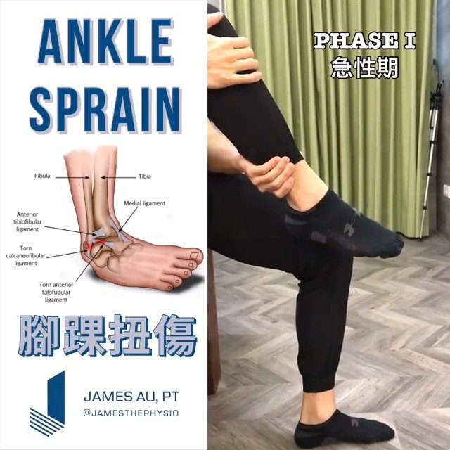 踝关节扭伤前期康复——保持踝关节活动度,预防粘连!