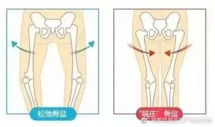 产后女性骨盆变形,容易造成妇科病不断!